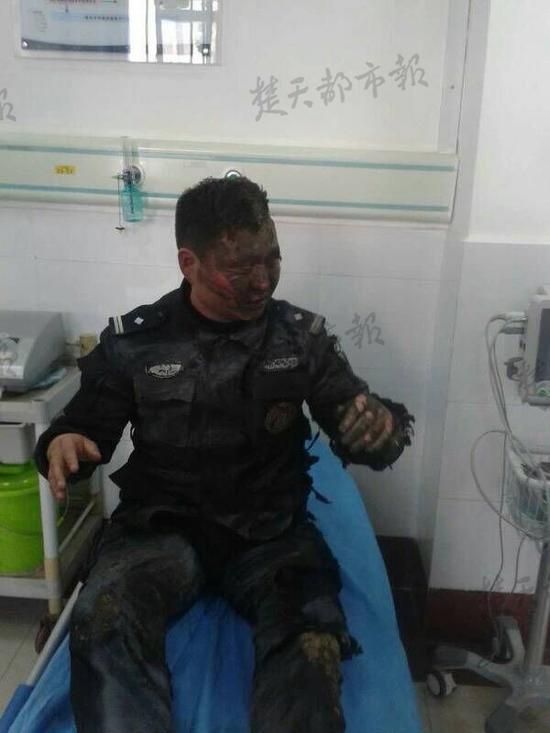 民警为保他人被炸重伤