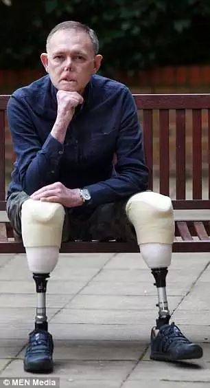 被爱犬舔舐后截肢