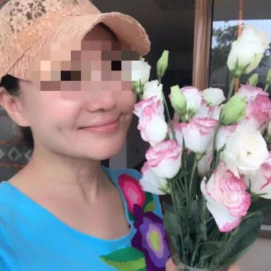 60岁老赖整成少女，颈部的皱纹暴露了老年的秘密