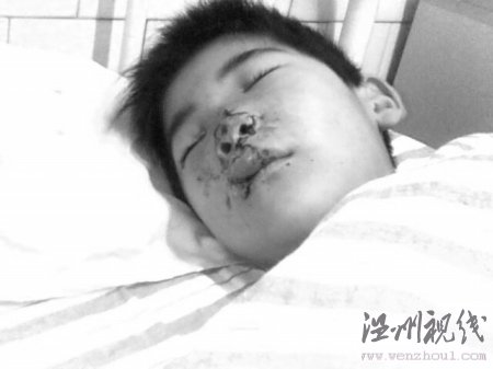 命危男孩救命捐款在医院遭遇用错药和收错费