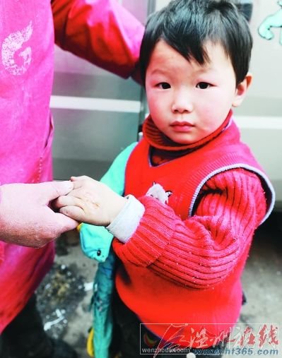○伍刚儿子的左手被烫伤。